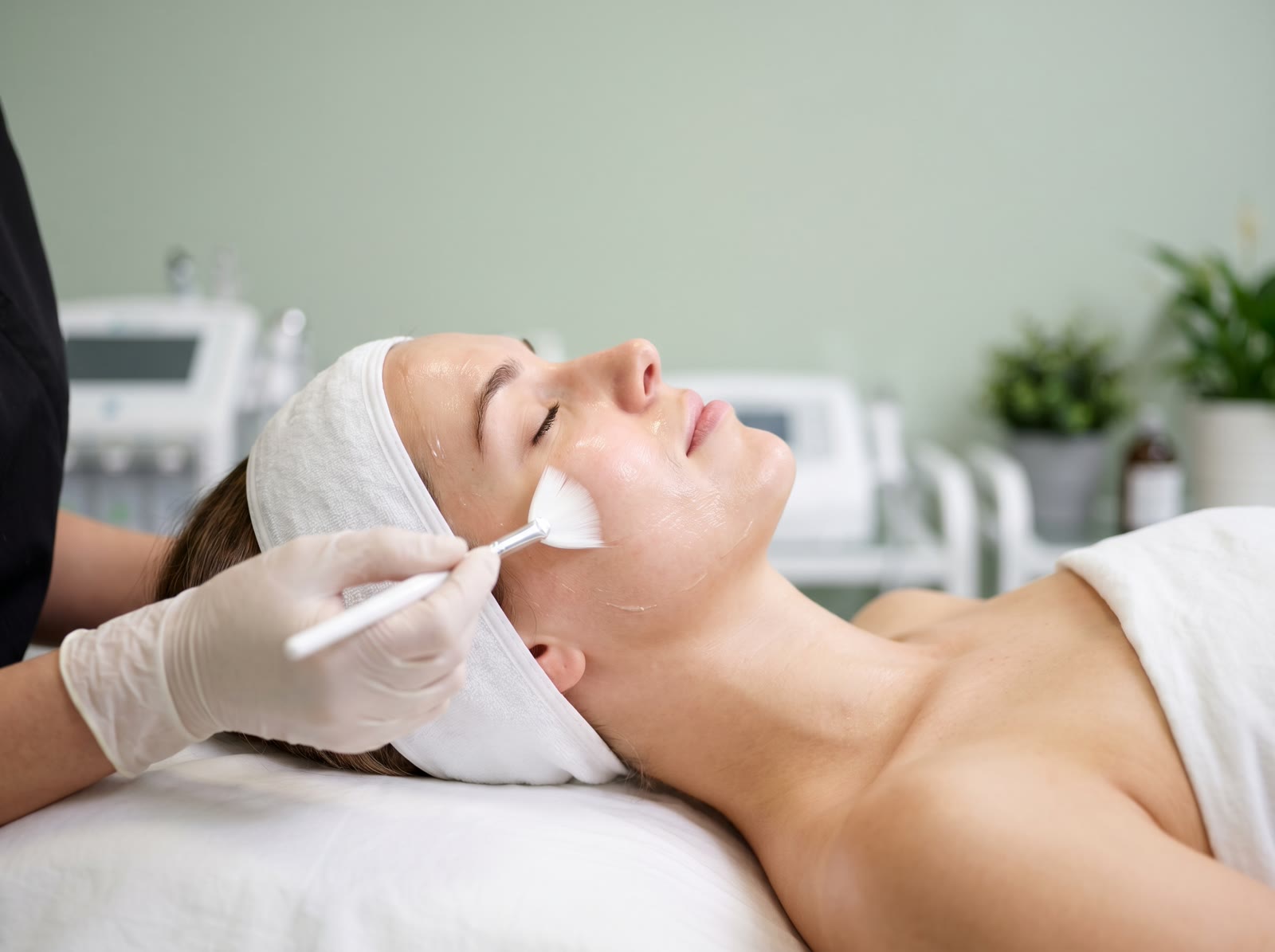 Skin peels Wellington — chemical peel application